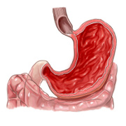 Gastritis related image
